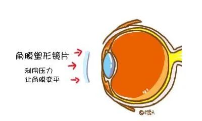 进出口眼镜报关若何归类？